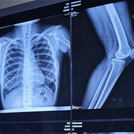 فیلم اشعه ایکس 10 X 12-